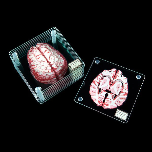 Brain Specimen Coasters - Image 3